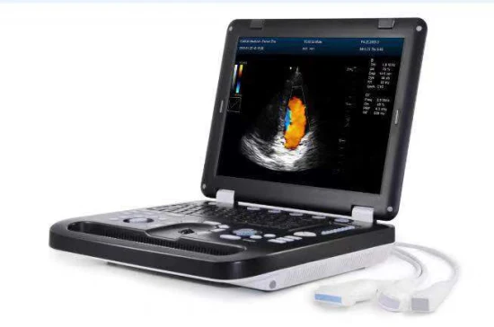 B-Ultrasonic Scanner pour ruminants